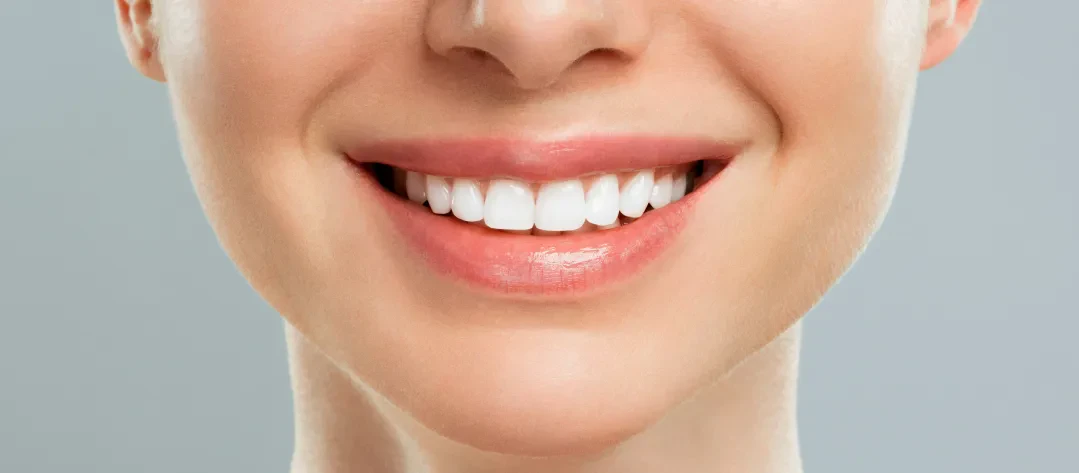 Cosmetic dentistry patients