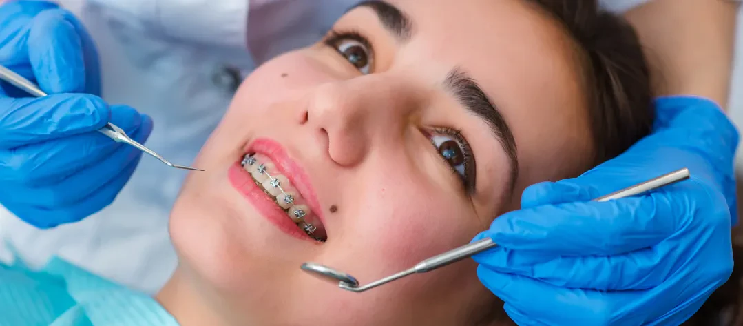 Orthodontics patients