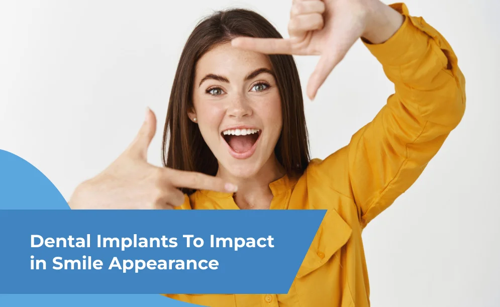 Dental Implants To Impact In Smile Appearance