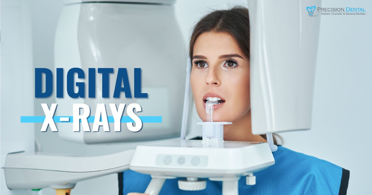 Digital XRays Glendale Dentist